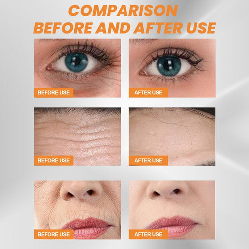 Before and after use comparison of skin and eyes of Collagen Film